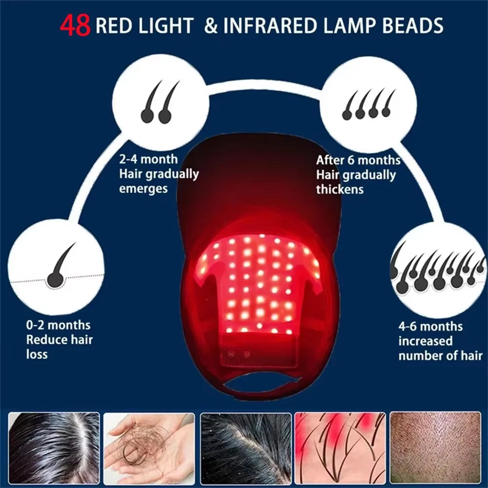 48 Leds Bead Portable Carry-On Light Panel Red&Blue Light Hair Fast Regrowth Hat Red Infrared Light Cap for Hair Loss Anti-Hairl